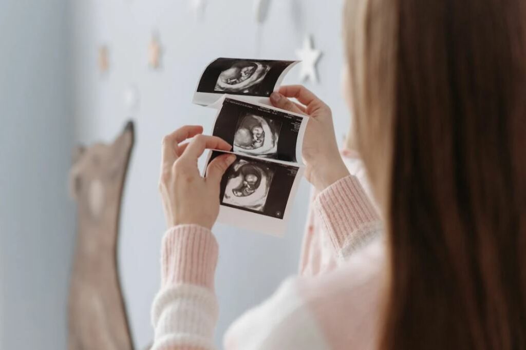 echographie femme enceinte
